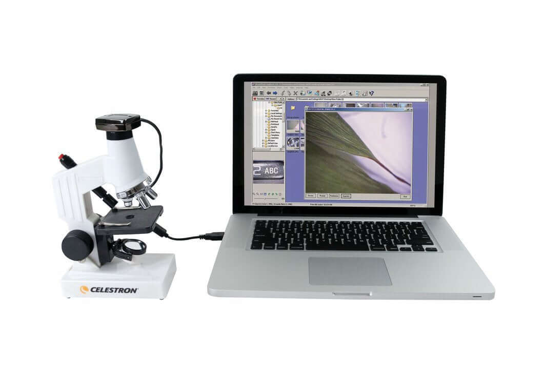 Microscopio Celestron con webcam collegato a computer portatile
